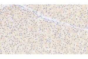 Detection of GSTa1 in Human Liver Tissue using Polyclonal Antibody to Glutathione S Transferase Alpha 1 (GSTa1)