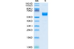 Human NKG2A/CD159a on Tris-Bis PAGE under reduced condition.