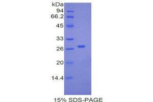 SDS-PAGE (SDS) image for alpha-2-HS-Glycoprotein (AHSG) (AA 19-250) protein (His tag) (ABIN1877251)