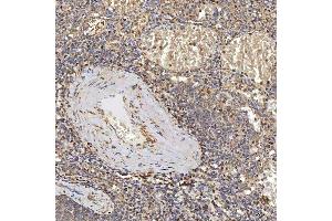 IHC analysis of SUCLG2 using anti-SUCLG2 antibody (ABIN7601694). (SUCLG2 anticorps  (AA 42-424))