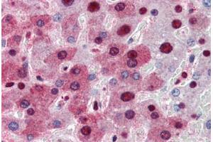 Human Liver (formalin-fixed, paraffin-embedded) stained with NPM1 antibody ABIN364324 at 5 ug/ml followed by biotinylated anti-mouse IgG secondary antibody ABIN481714, alkaline phosphatase-streptavidin and chromogen. (NPM1 anticorps  (AA 81-294))