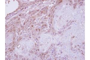IHC-P Image Immunohistochemical analysis of paraffin-embedded Ca922 xenograft, using TPRKB, antibody at 1:250 dilution.