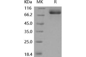 Western Blotting (WB) image for Meprin A, alpha (PABA Peptide Hydrolase) (MEP1A) (Active) protein (His tag) (ABIN7196977)