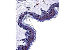 Tyrosinase Antibody (C-term) ((ABIN391520 and ABIN2841480))immunohistochemistry analysis in formalin fixed and paraffin embedded human skin tissue followed by peroxidase conjugation of the secondary antibody and DAB staining.