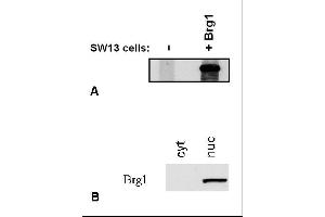 Immunostaining of Brg1 by BRG-01 antibody. (SMARCA4 anticorps  (C-Term))