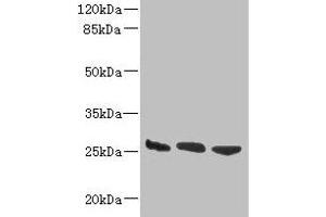 Western blot All lanes: DNAJB8 antibody at 8 μg/mL Lane 1: Hela whole cell lysate Lane 2: Mouse brain tissue Lane 3: Mouse liver tissue Secondary Goat polyclonal to rabbit IgG at 1/10000 dilution Predicted band size: 26 kDa Observed band size: 26 kDa (DNAJB8 anticorps  (AA 1-232))
