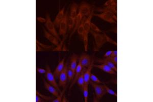anti-Numb Homolog (NUMB) (AA 521-640) antibody