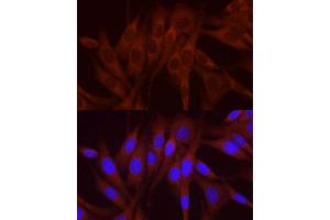 Immunofluorescence analysis of NIH/3T3 cells using NUMB Rabbit pAb (ABIN6129424, ABIN6144943, ABIN6144944 and ABIN6224990) at dilution of 1:250 (40x lens). (NUMB anticorps  (AA 521-640))