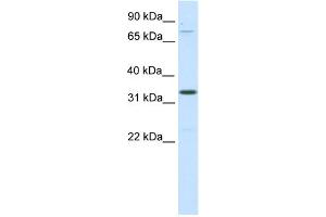WB Suggested Anti-Duxbl Antibody Titration:  0. (DUXBL1 anticorps  (C-Term))