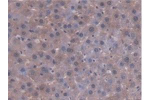 Detection of AT in Rat Liver Tissue using Polyclonal Antibody to Antithrombin (AT) (SERPINC1 anticorps  (AA 33-465))