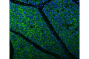 IF analysis of Citrin/SLC25A13 using anti-Citrin/SLC25A13 antibody (ABIN7599512). (slc25a13 anticorps  (AA 1-643))