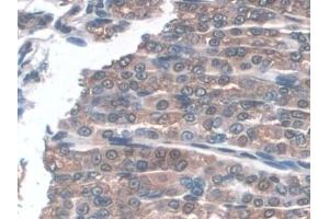 Detection of GPX3 in Mouse Stomach Tissue using Polyclonal Antibody to Glutathione Peroxidase 3, Plasma (GPX3)