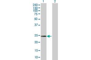 Western Blot analysis of ARHGDIB expression in transfected 293T cell line by ARHGDIB MaxPab polyclonal antibody. (ARHGDIB anticorps  (AA 1-201))