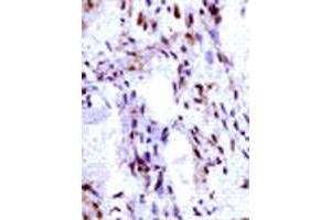 Immunohistochemical analysis of IGF2 expression in human ovarian vascular endothelial cells. (IGF2 anticorps  (C-Term))