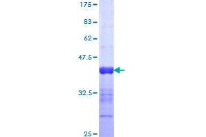Image no. 1 for Nuclear Factor of Activated T-Cells 5, Tonicity-Responsive (NFAT5) (AA 1422-1531) protein (GST tag) (ABIN1312438)