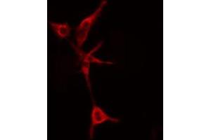 ABIN6274808 staining COLO205 cells by IF/ICC. (LYPLA1 anticorps  (Internal Region))