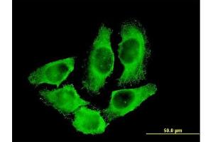 Immunofluorescence of monoclonal antibody to CKM on HeLa cell.