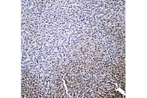 IHC analysis of RXRA using anti-RXRA antibody .