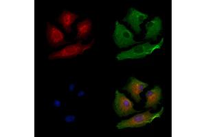 ABIN6264206 and ABIN6279656 staining  cells by IF/ICC. (PIGP anticorps  (Internal Region))