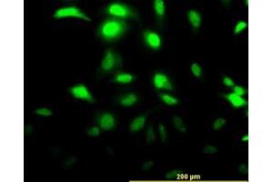 Image no. 2 for anti-Chloride Intracellular Channel 3 (CLIC3) (AA 137-237) antibody (ABIN465974)