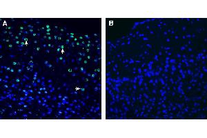 Expression of NPTX2 in mouse cortex. (NPTX2 anticorps  (Secreted))