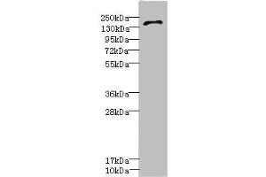 Western blot All lanes: GRIN2D antibody IgG at 3. (GRIN2D anticorps  (AA 330-480))
