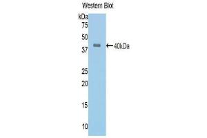 Western blot analysis of the recombinant protein. (Angiotensin I Converting Enzyme 1 anticorps  (AA 504-597))