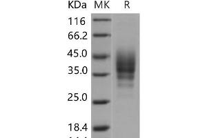 Western Blotting (WB) image for CD2 (CD2) protein (His tag) (ABIN7320241) (CD2 Protein (CD2) (His tag))