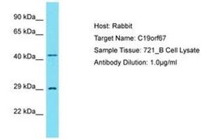Image no. 1 for anti-Chromosome 19 Open Reading Frame 67 (C19ORF67) (N-Term) antibody (ABIN6750822) (C19ORF67 anticorps  (N-Term))