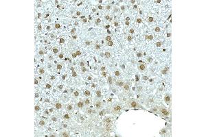 Immunohistochemistry of paraffin-embedded mouse liver using NOP10 Rabbit mAb (ABIN7268953) at dilution of 1:50 (40x lens).