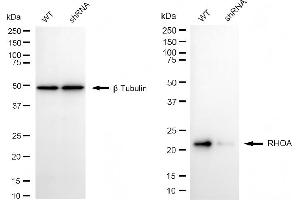 Western blotting analysis using RHOA antibody (ABIN7800142). (Recombinant RHOA anticorps)