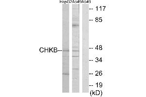 Western blot analysis of extracts from HepG2 cells and A549 cells, using CHKB antibody. (CHKB anticorps)