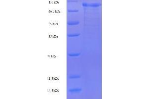 SDS-PAGE (SDS) image for Mannan-Binding Lectin Serine Peptidase 1 (MASP1) (AA 20-699) protein (His-SUMO Tag) (ABIN5709915)