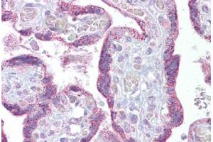 Anti-TRPC4 antibody IHC staining of human placenta.