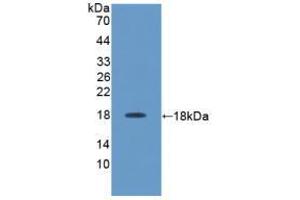 Western blot analysis of recombinant Rat IL17. (IL-17 anticorps  (AA 18-150))