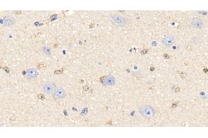 Detection of PRDX6 in Bovine Cerebrum Tissue using Polyclonal Antibody to Peroxiredoxin 6 (PRDX6)