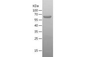 Western Blotting (WB) image for Papillary Renal Cell Carcinoma (Translocation-Associated) (PRCC) (AA 215-491) protein (His-IF2DI Tag) (ABIN7124307)