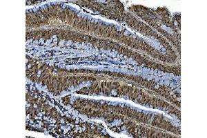 IHC analysis of MCM4 using anti-MCM4 antibody (ABIN7601485).