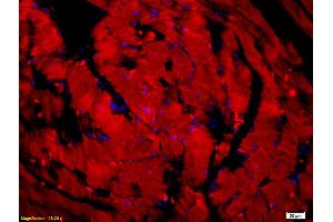 Formalin-fixed and paraffin embedded mouse heart tissue labeled with Anti-LSP1 Polyclonal Antibody, unconjugated (ABIN755632) at 1: 200 followed by incubation with conjugated secondary antibody (Goat Anti-Rabbit IgG, Cy3 conjugated   used at 1: 200 dilution for 40 minutes at 37°C and DAPI staining).