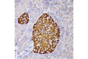 Immunohistochemistry of paraffin-embedded mouse pancreatic islet using Synaptophysin Rabbit pAb (ABIN6135349, ABIN6148783, ABIN6148784 and ABIN6221958) at dilution of 1:200 (40x lens).