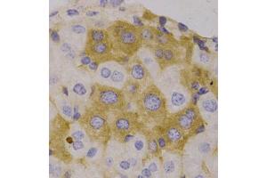 Immunohistochemistry of paraffin-embedded human liver, using NBR1 antibody (ABIN5972123). (NBR1 anticorps)