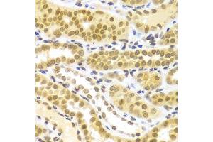 Immunohistochemistry of paraffin-embedded human kidney using ELAVL1 Antibody.