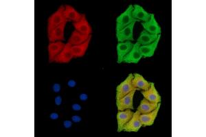 ABIN7096440 and ABIN7100504 staining Hela cells by IF/ICC. (SPG7 anticorps)