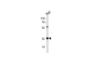 Western blot analysis of lysate from Raji cell line,using ACOT8 Antibody (ABIN6241571). (ACOT8 anticorps)