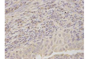 Immunohistochemistry (IHC) image for anti-Ribosomal Protein, Large, P0 (RPLP0) antibody (ABIN1876737) (RPLP0 anticorps)