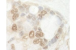 Immunohistochemistry (IHC) image for anti-CCR4-NOT Transcription Complex, Subunit 2 (CNOT2) (AA 490-540) antibody (ABIN7448479) (CNOT2 anticorps  (AA 490-540))