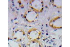 Used in DAB staining on fromalin fixed paraffin-embedded Kidney tissue (APP anticorps  (AA 672-711))
