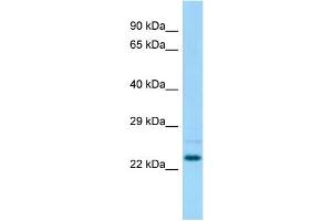 Host: Rabbit Target Name: Nsg1 Sample Type: Rat Testis lysates Antibody Dilution: 1. (NSG1 anticorps  (N-Term))