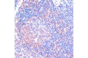 Immunohistochemistry of paraffin-embedded mouse spleen using RPS6K antibody (ABIN7270037) at dilution of 1:100 (40x lens). (RPS6KA2 anticorps  (AA 632-733))