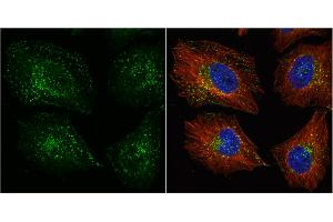ICC/IF Image VPS35 antibody [C3], C-term detects VPS35 protein at cytoplasm by immunofluorescent analysis.